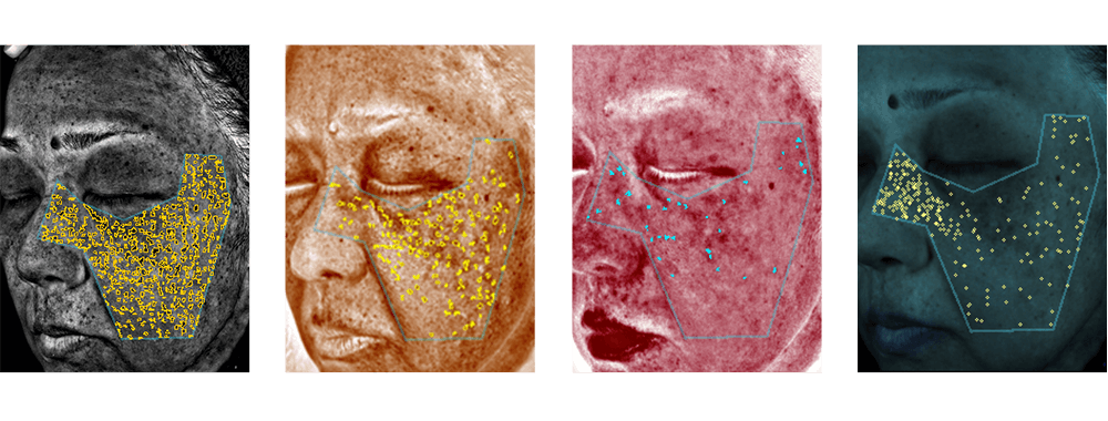 臨床試験イメージ2
