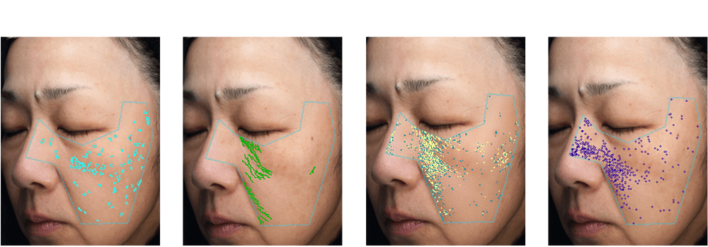 臨床試験イメージ1